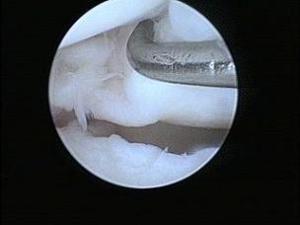 figure 3 entorse