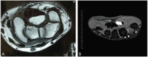 fig cc3