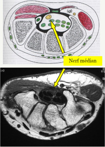 fig cc4